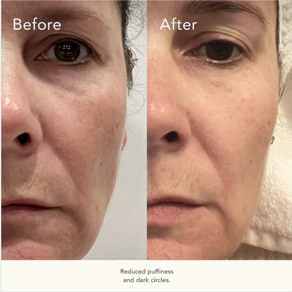 KAT BURKI REVERSAL ROSE HIP INTENSE RECOVERY EYE SERUM! BRAND NEW In the box! - Picture 4 of 13